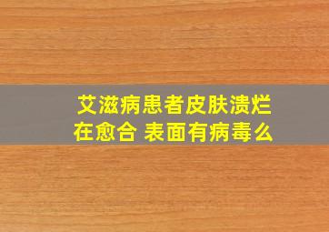 艾滋病患者皮肤溃烂在愈合 表面有病毒么